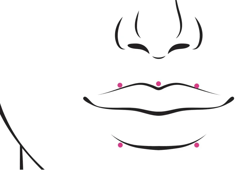 Chicago Lip Flip Botox Treatment Pinch Med Spa